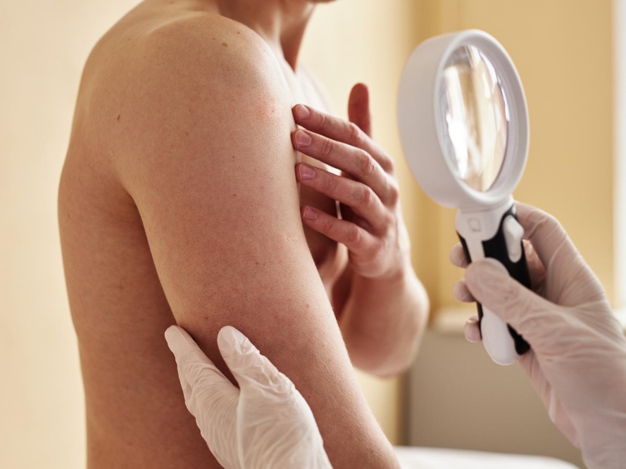 Medical Dermatology in Mumbai